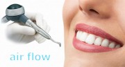 Чистка зубов Air Flow в стоматологии