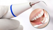 Противопоказания ультразвуковой чистки зубов