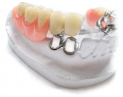 Выбор опорных зубов для фиксации протезов
