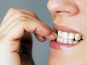 Вредные привычки и здоровье зубов