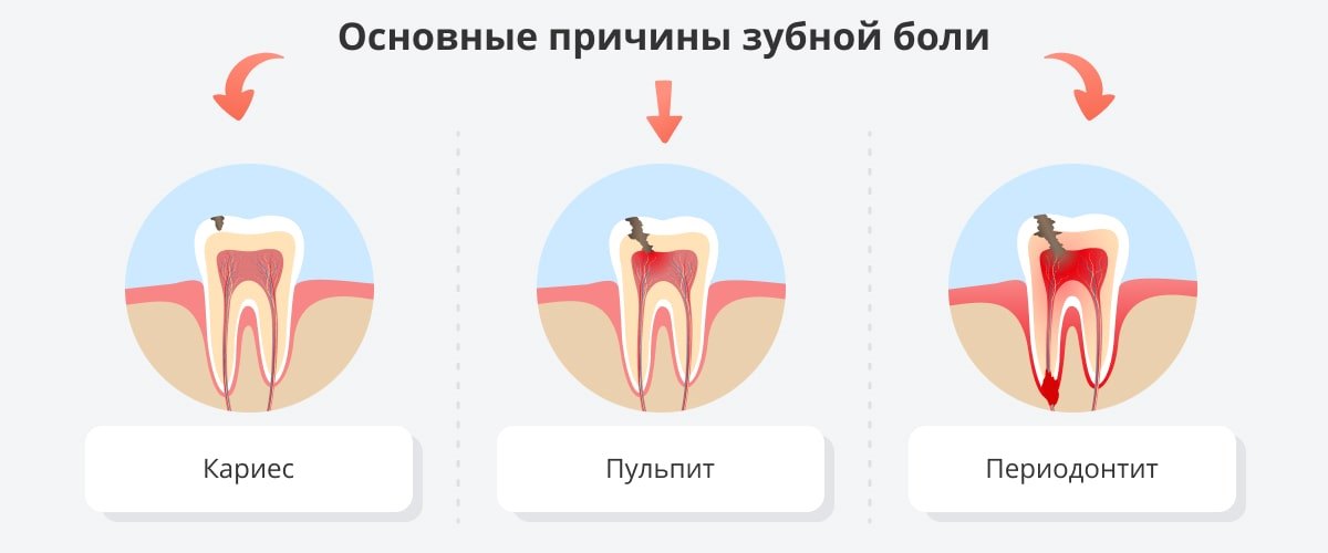 Сильная зубная боль что делать в домашних. Ноющая боль в зубе причина.