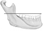 Окклюзионная поверхность зуба