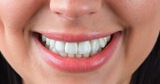 Полная реставрация зубов пациентов