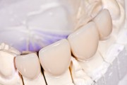 Реставрация зубов стеклокерамическими коронками