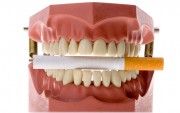 Противопоказано ли курение при имплантации зубов?
