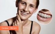 Сколько стоит выпрямить зубы брекетами в 2019