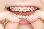 Этапы лечения брекетами в стоматологии