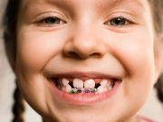 Неровные зубы у ребенка
