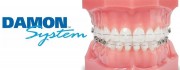 Ортодонтические системы Damon