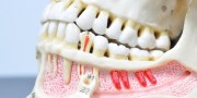 Болезни зубов у человека
