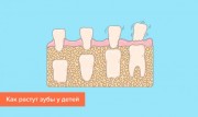 Отличия между молочными и коренными зубами