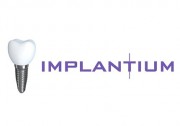 Импланты Implantium