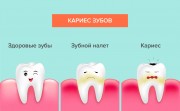 Причины разрушения зубов