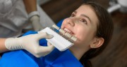 Как часто можно обеливать зубы в стоматологии