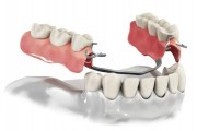 Ортопедические конструкции в стоматологии