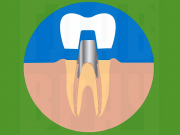 Штифт в зубе при протезировании