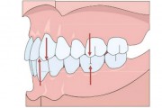 Расположение зубов при правильном прикусе