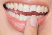 Чем опасны невылеченные зубы?