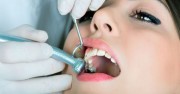 Прогноз повторного лечения зубов