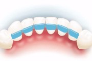 Шинирование зубов при травме