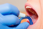 Профессиональная чистка зубов детям в стоматологии