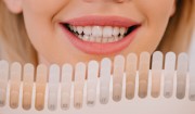 От чего зависит естественный цвет зубов?
