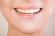 Желтизна зубов