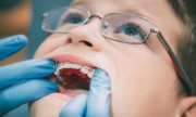Зачем нужна консультация детского ортодонта?