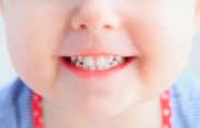Способы лечения кариеса молочных зубов