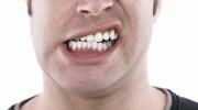 Почему зубы у взрослых становятся кривыми?