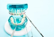 Пакет снимков перед ортодонтическим лечением
