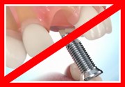 Вред имплантов зубов