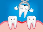 Как производится удаление молочного зуба с сохранёнными корнями?