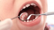 Нуждаются ли в лечении молочные зубы?