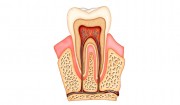 Зачем зубам нервы? Почему зубная боль такая сильная ?